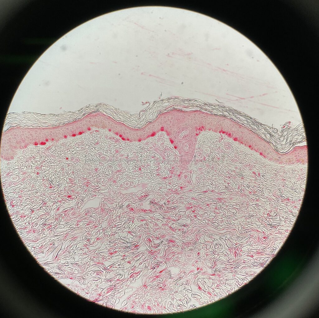 Microscope slide image that is a circle with white and pink stain throughout